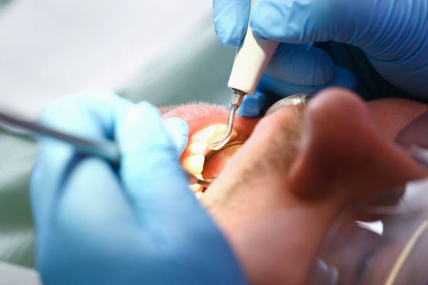 Best Emergency Care for Gum Disease in Texarkana, TX